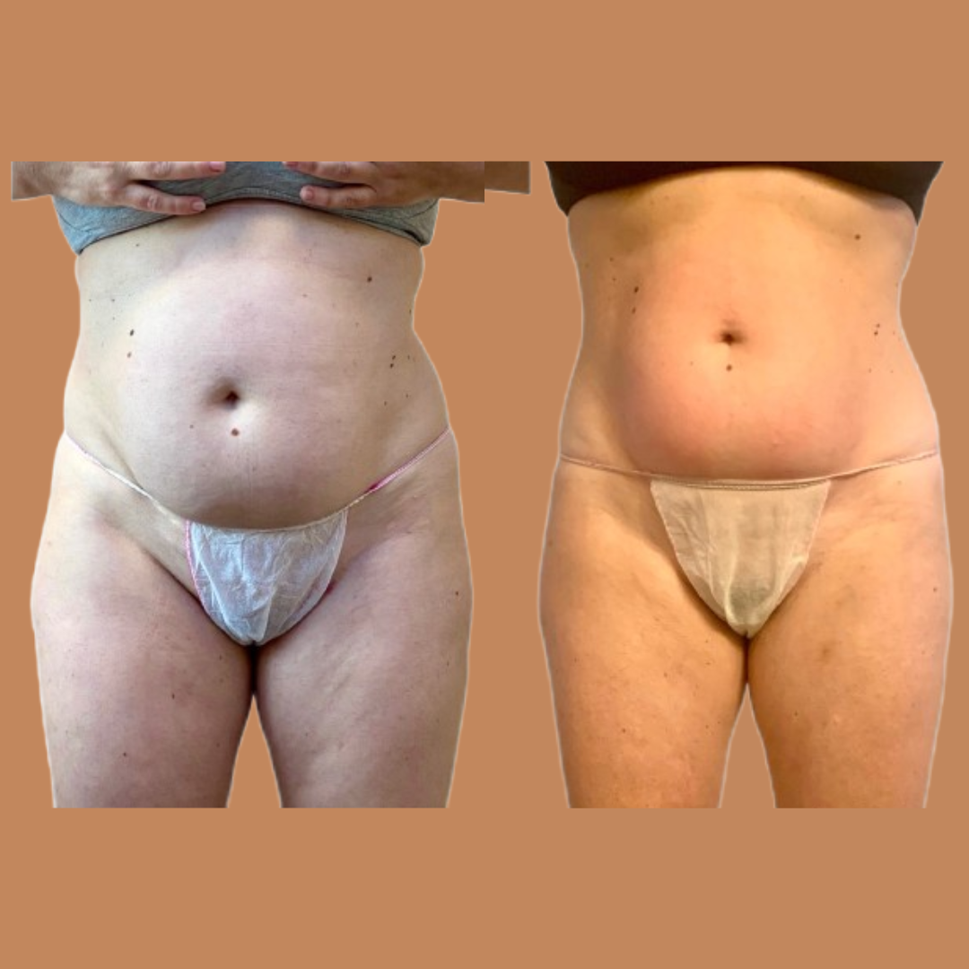 RimodellaPro - Corpo Tonico Senza Rinunce